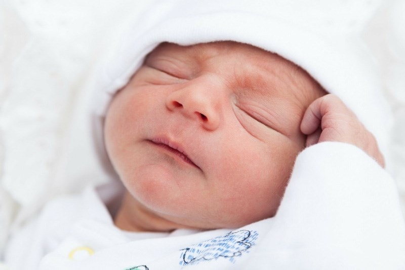 newborn with mild eczema on face 