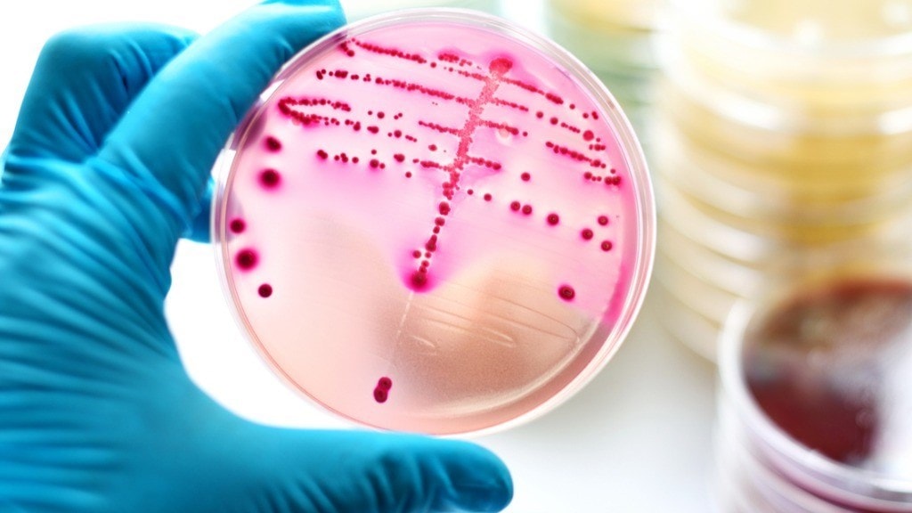 Scientist with bacteria on agar plate