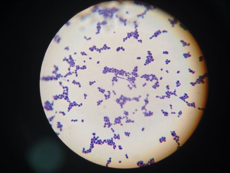 bacteria on a petri dish 